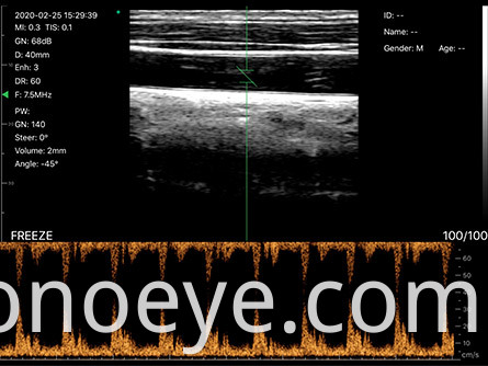 c5l color doppler